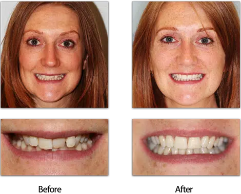 smilemonth carrie