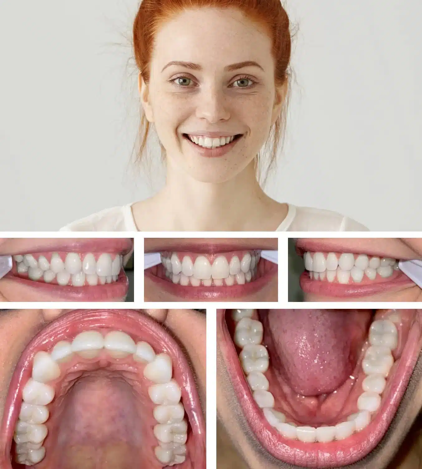dental video consultation demo pics to be taken ch