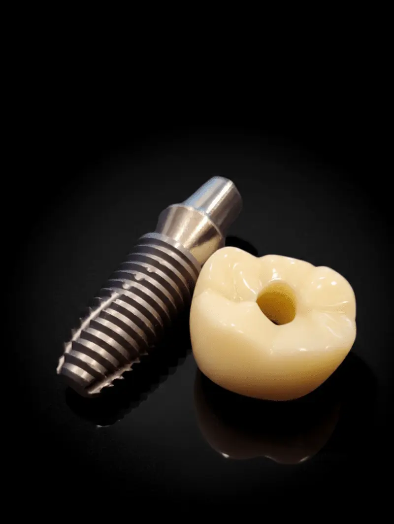 dental implants london