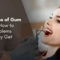 Early Signs of Gum Disease: How to Catch Problems Before They Get Serious thumbnail