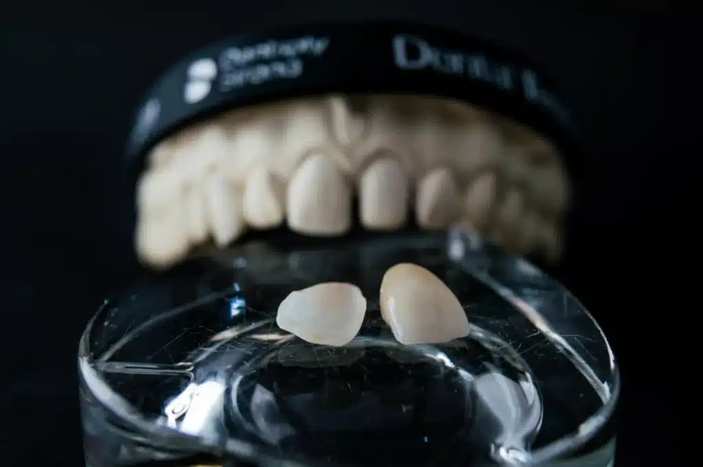 High quality affordable dentistry in Swiss Cottage High quality affordable dentistry in Swiss Cottage