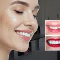 What Your AI Smile Simulation Gets Right (and Wrong) Before Veneers or Bonding thumbnail