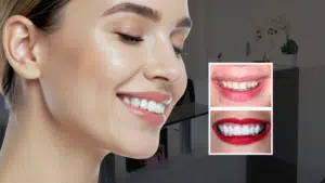 cosmetic dentistry london