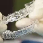 Invisalign treatment
