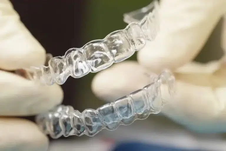 invisalign treatment