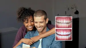 teeth whitening
