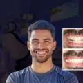 can you actually stop gum recession from getting worse? what works and what doesn’t thumbnail