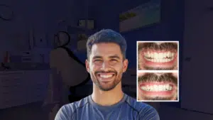 gum recession