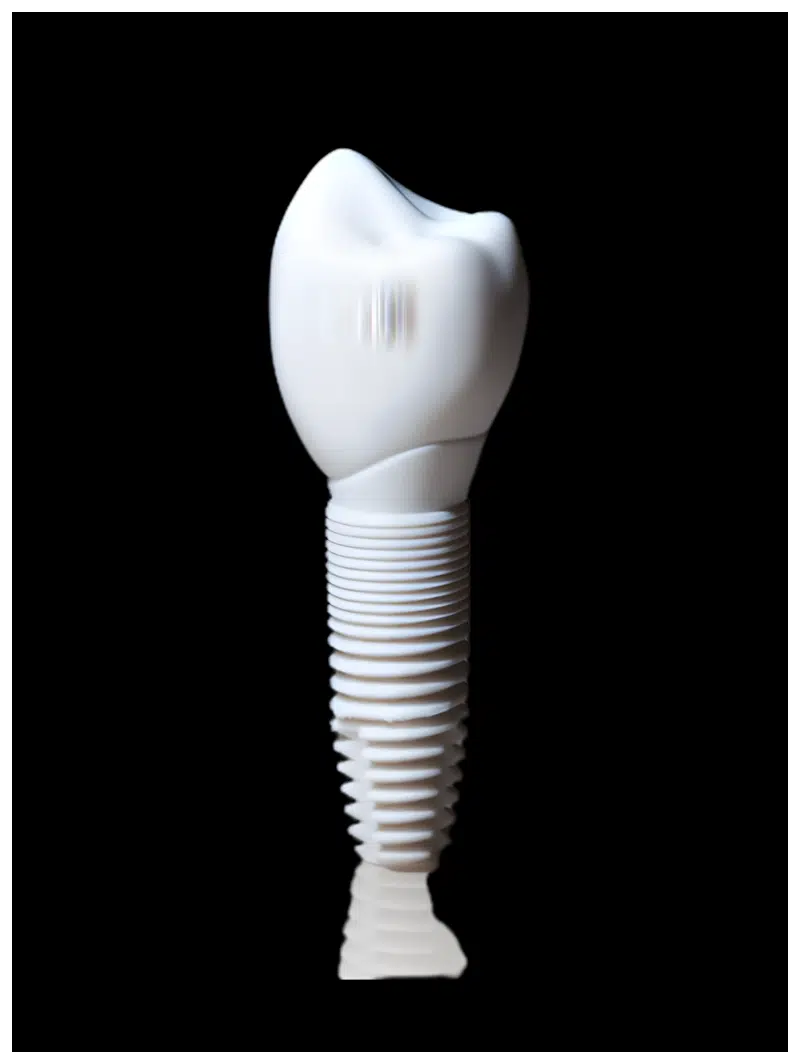 What Are Ceramic Dental Implants